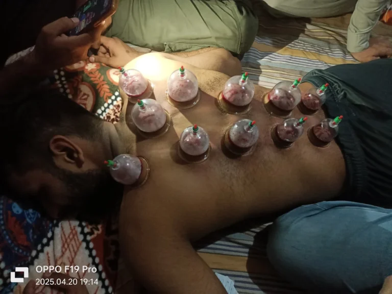 Hijama services in Karachi