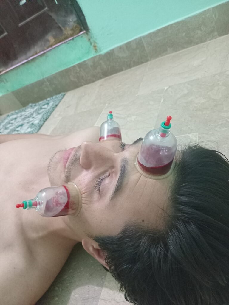 Physiotheraphy Services in KArachi