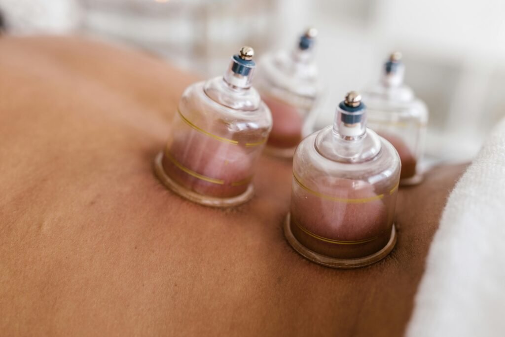 Hijama Services in Karachi – Natural Healing Through Sunnah Therapy 2 Physiotheraphy Services in KArachi